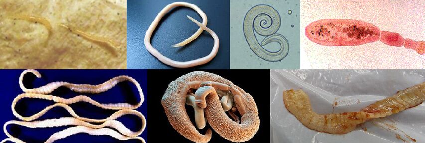 Diferentes tipos de parásitos