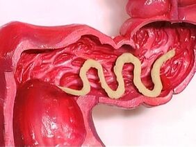 parásitos en el cuerpo humano por qué aparecen