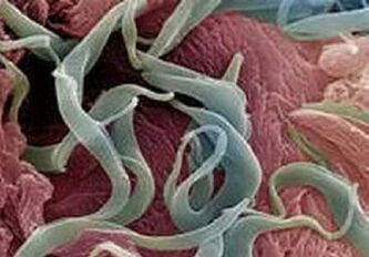 Síntomas y tratamiento de parásitos en el cuerpo humano