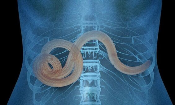 parásito en el cuerpo humano