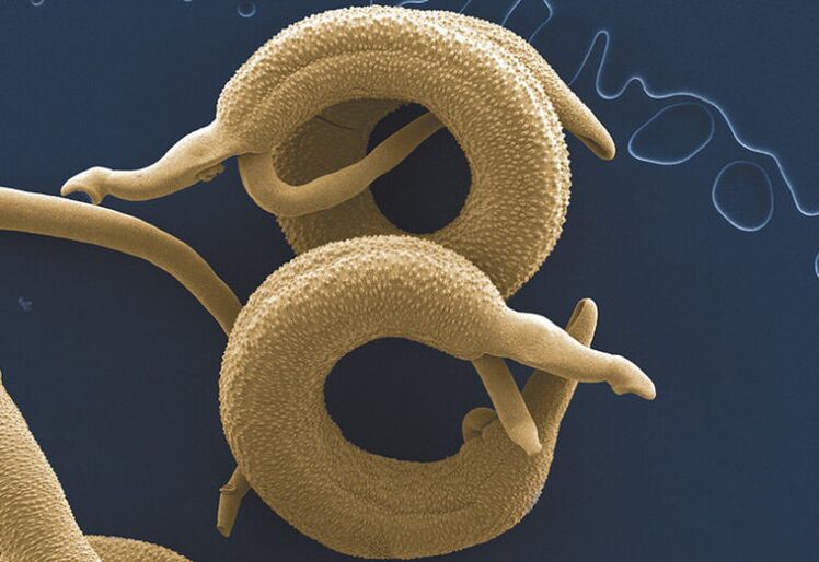 parásitos que viven en el cuerpo humano