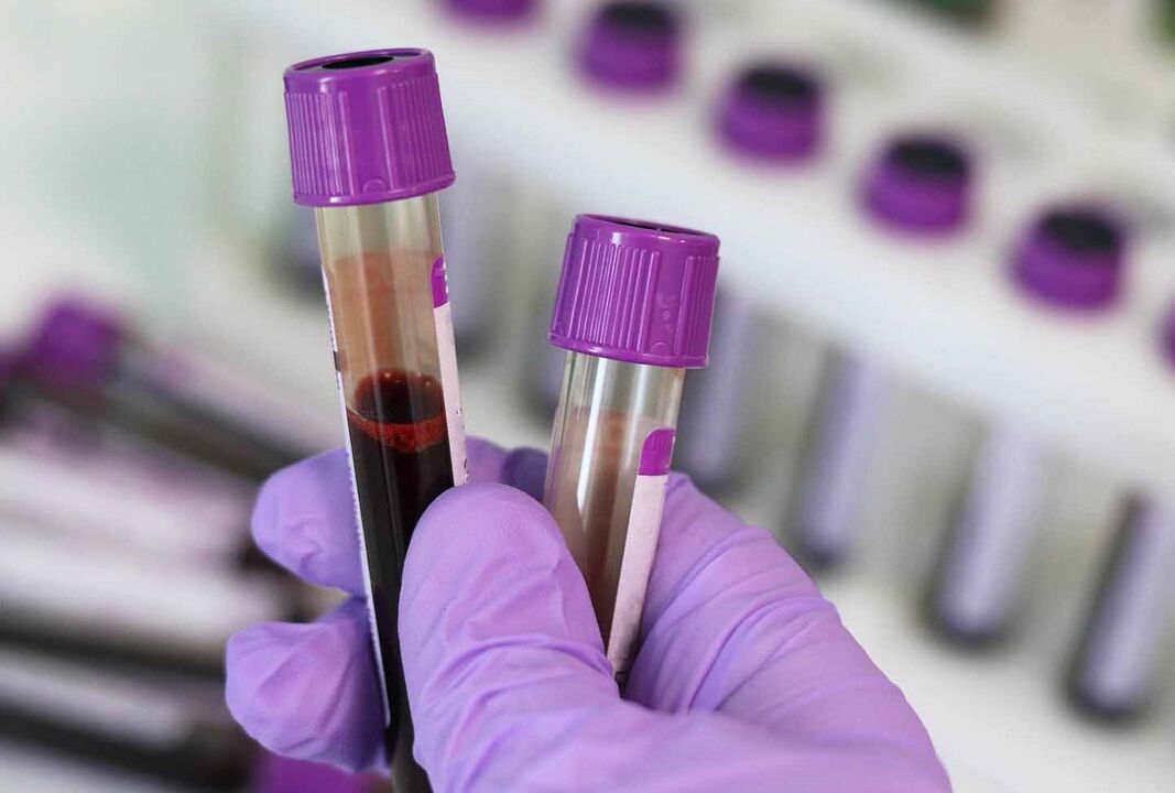 análisis de sangre para parásitos